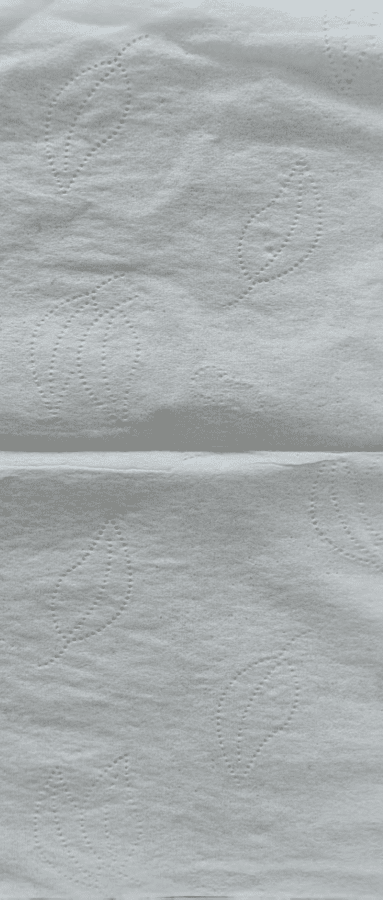 soft facial tissue surface pattern-one